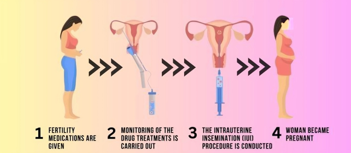 best IUI treatment in Ghaziabad